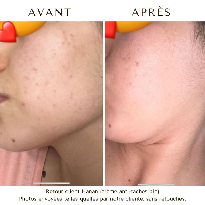 CRÈME ANTI-TACHES FIGUE DE BARBARIE BIO • cicatrices & taches - LAYLI