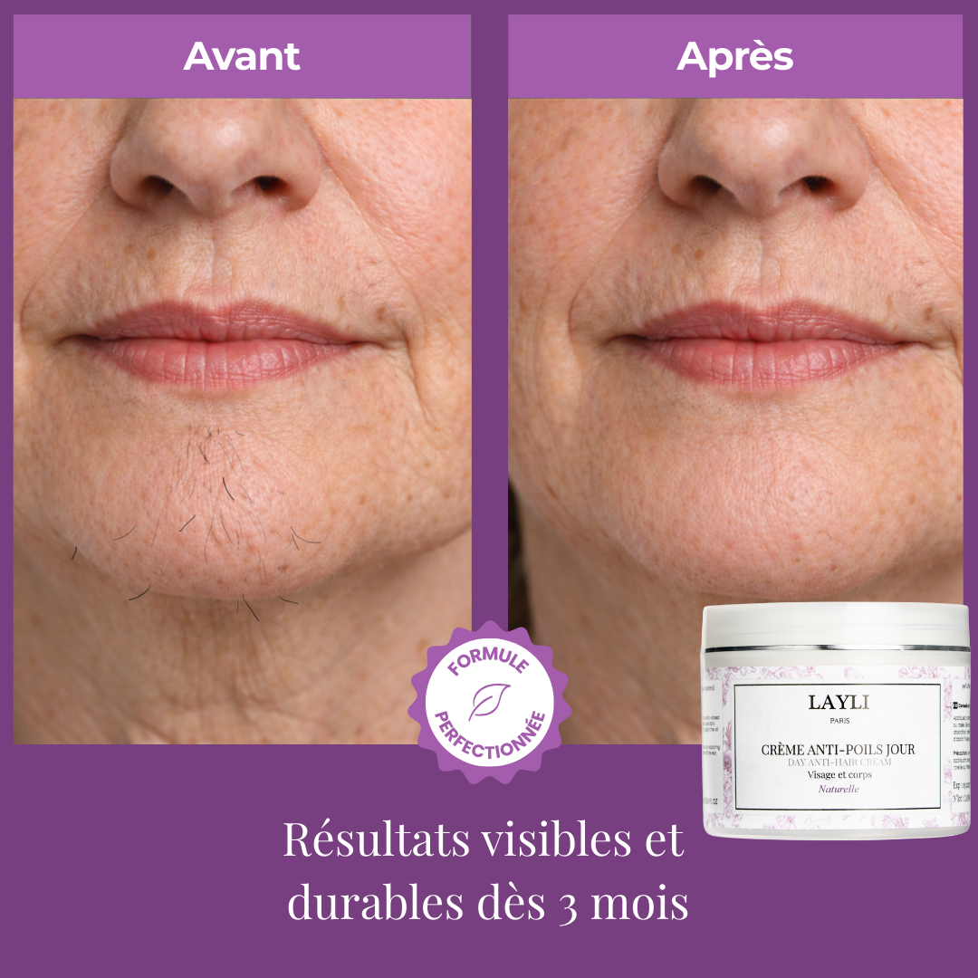 CRÈME ANTI-POILS JOUR • disparition définitive des poils !